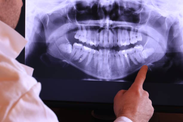 Best Emergency Denture Repair in University Heights, IA